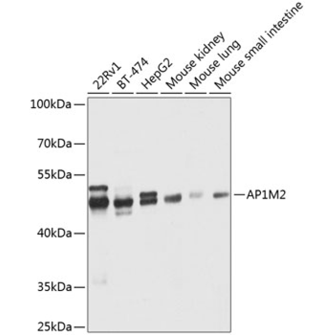 AP1M2 Rabbit Polyclonal Antibody