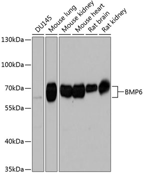 BMP6 Rabbit Polyclonal Antibody