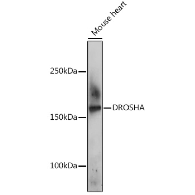 DROSHA Rabbit Polyclonal Antibody