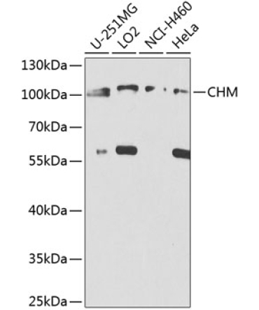 CHM Rabbit Polyclonal Antibody