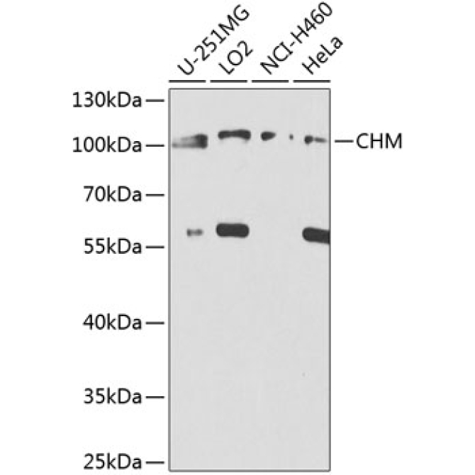 CHM Rabbit Polyclonal Antibody