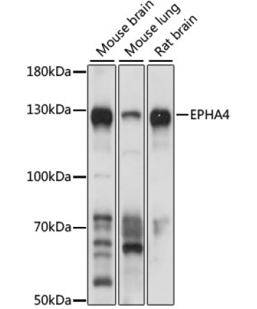 EPHA4 Rabbit Polyclonal Antibody