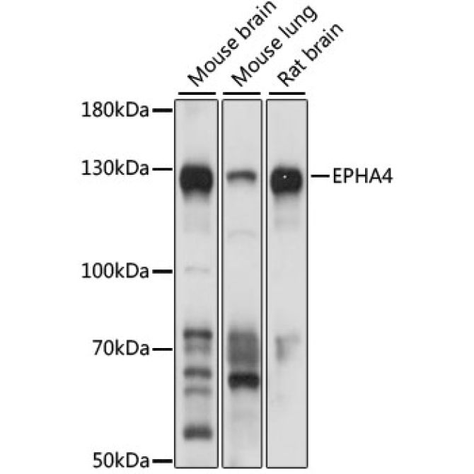 EPHA4 Rabbit Polyclonal Antibody