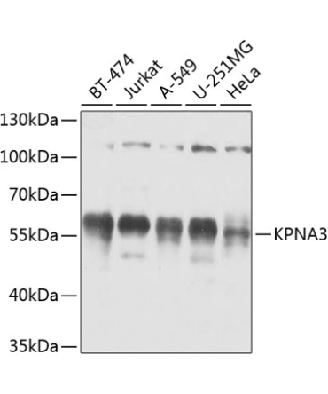 KPNA3 Rabbit Polyclonal Antibody