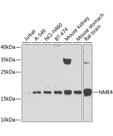 NME4 Rabbit Polyclonal Antibody