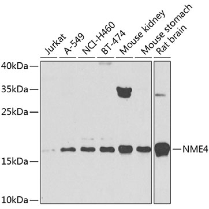 NME4 Rabbit Polyclonal Antibody