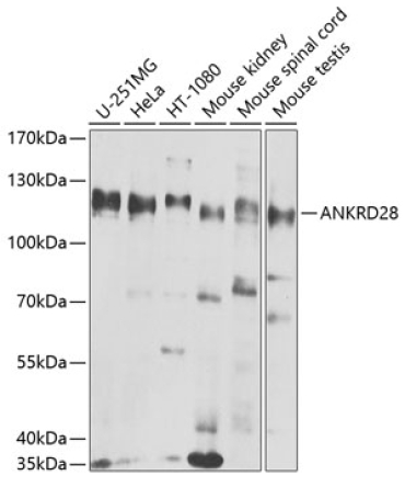 ANKRD28 Rabbit Polyclonal Antibody