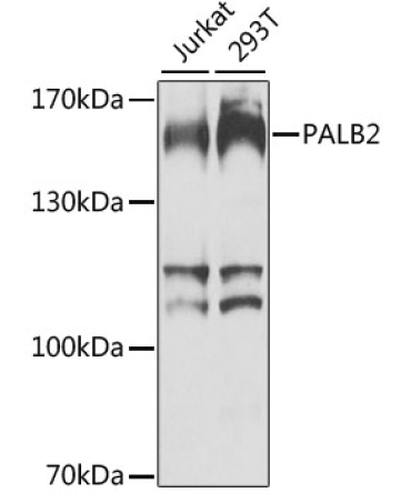 PALB2 Rabbit Polyclonal Antibody