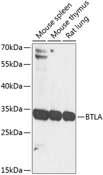 BTLA Rabbit Polyclonal Antibody
