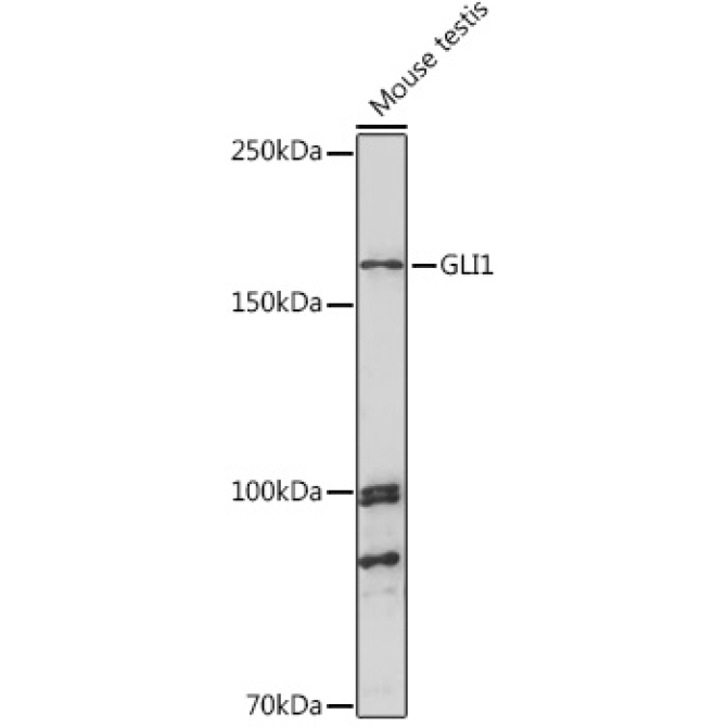 GLI1 Rabbit Polyclonal Antibody