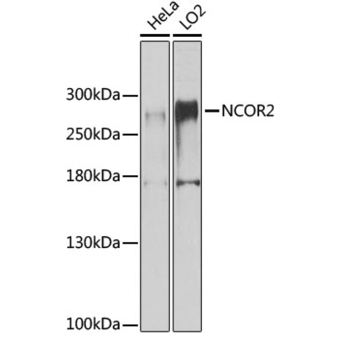 NCOR2 Rabbit Polyclonal Antibody