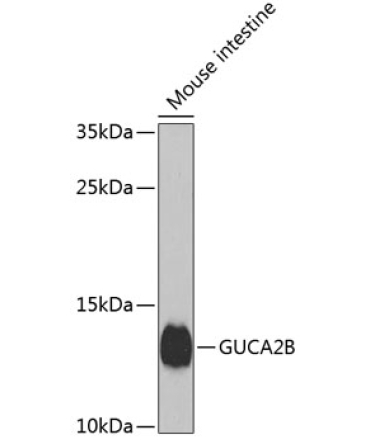 GUCA2B Rabbit Polyclonal Antibody