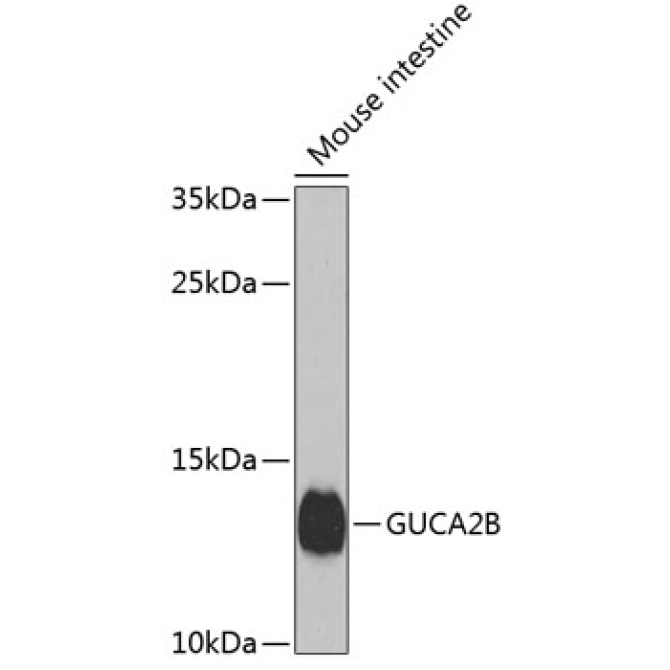 GUCA2B Rabbit Polyclonal Antibody