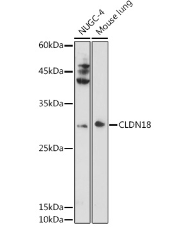 CLDN18 Rabbit Polyclonal Antibody