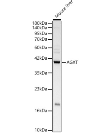 AGXT Rabbit Polyclonal Antibody