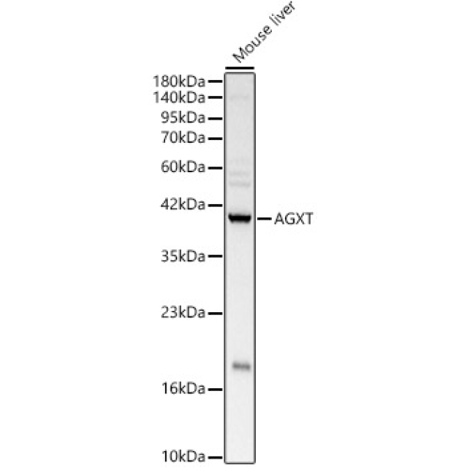 AGXT Rabbit Polyclonal Antibody
