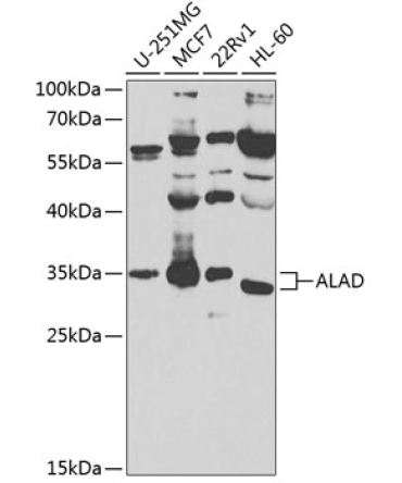 ALAD Rabbit Polyclonal Antibody