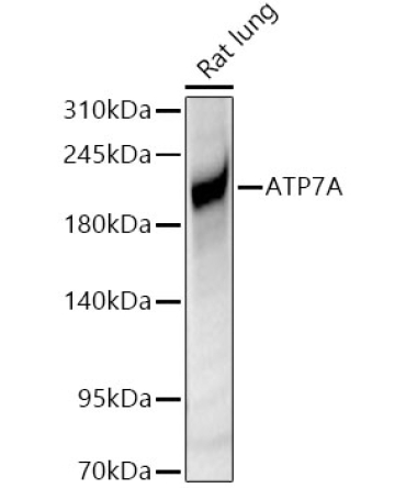 ATP7A Rabbit Polyclonal Antibody