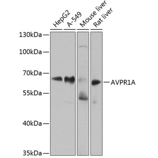 AVPR1A Rabbit Polyclonal Antibody
