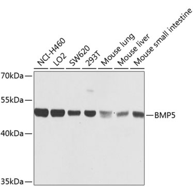 BMP5 Rabbit Polyclonal Antibody