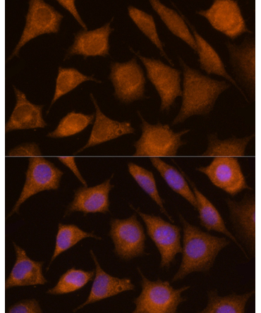 CTSC Rabbit Polyclonal Antibody