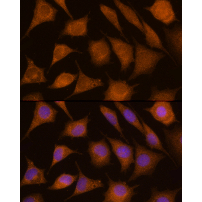 CTSC Rabbit Polyclonal Antibody