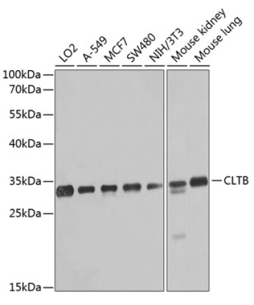 CLTB Rabbit Polyclonal Antibody