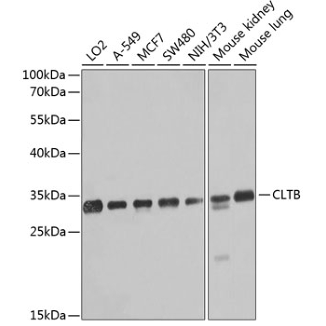 CLTB Rabbit Polyclonal Antibody