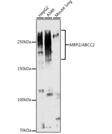 MRP2/ABCC2 Rabbit Polyclonal Antibody
