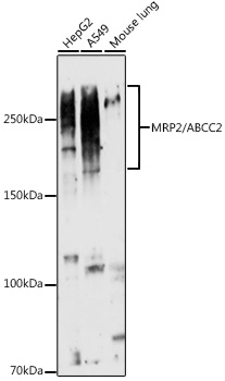 MRP2/ABCC2 Rabbit Polyclonal Antibody