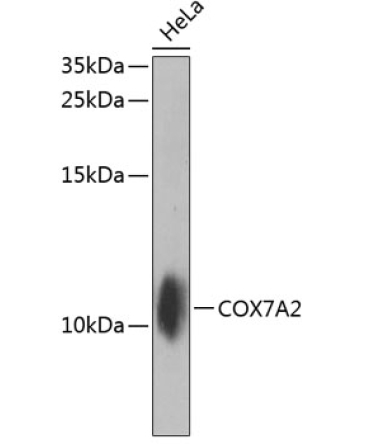 COX7A2 Rabbit Polyclonal Antibody
