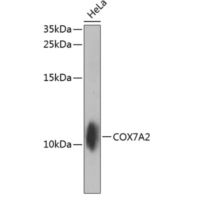 COX7A2 Rabbit Polyclonal Antibody