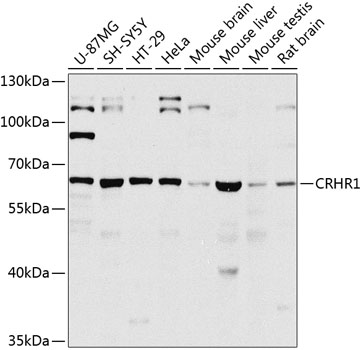 CRHR1 Rabbit Polyclonal Antibody