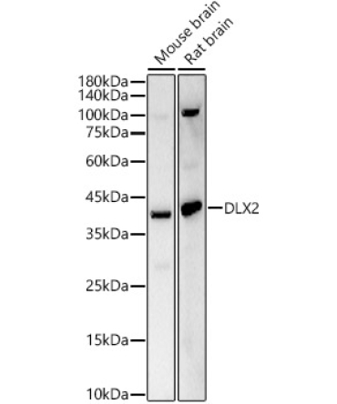 DLX2 Rabbit Polyclonal Antibody