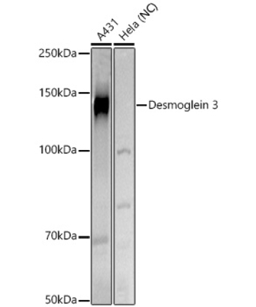 Desmoglein 3 Rabbit Polyclonal Antibody
