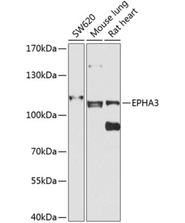 EPHA3 Rabbit Polyclonal Antibody