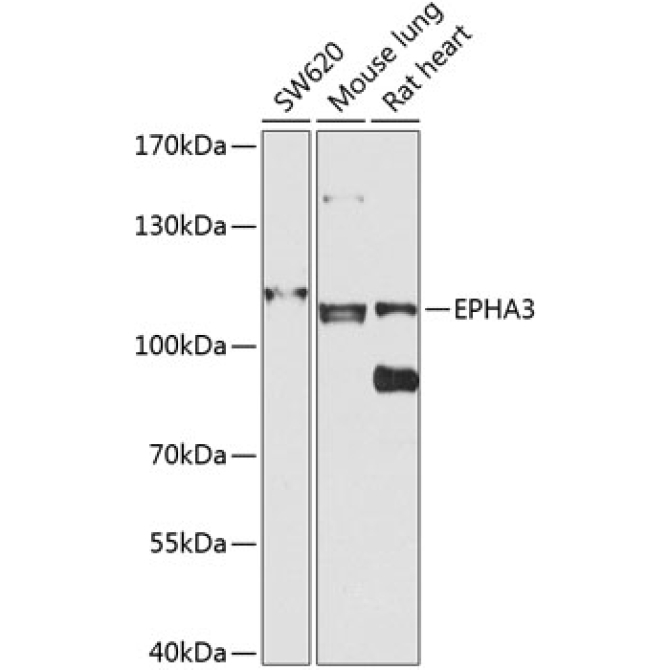 EPHA3 Rabbit Polyclonal Antibody