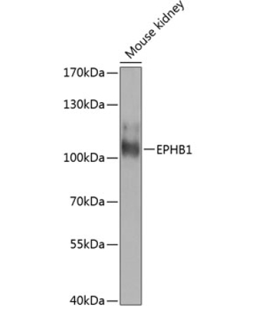 EPHB1 Rabbit Polyclonal Antibody
