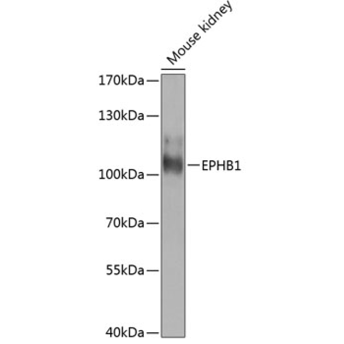 EPHB1 Rabbit Polyclonal Antibody