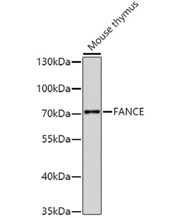 FANCE Rabbit Polyclonal Antibody