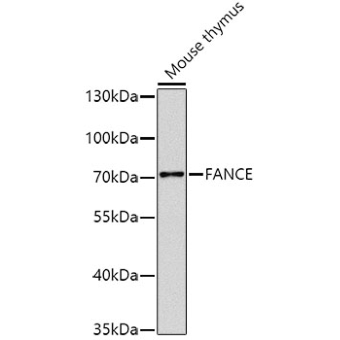 FANCE Rabbit Polyclonal Antibody