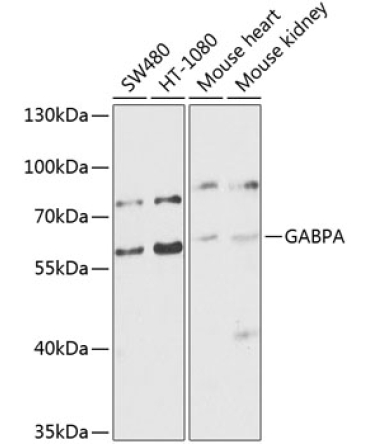 GABPA Rabbit Polyclonal Antibody