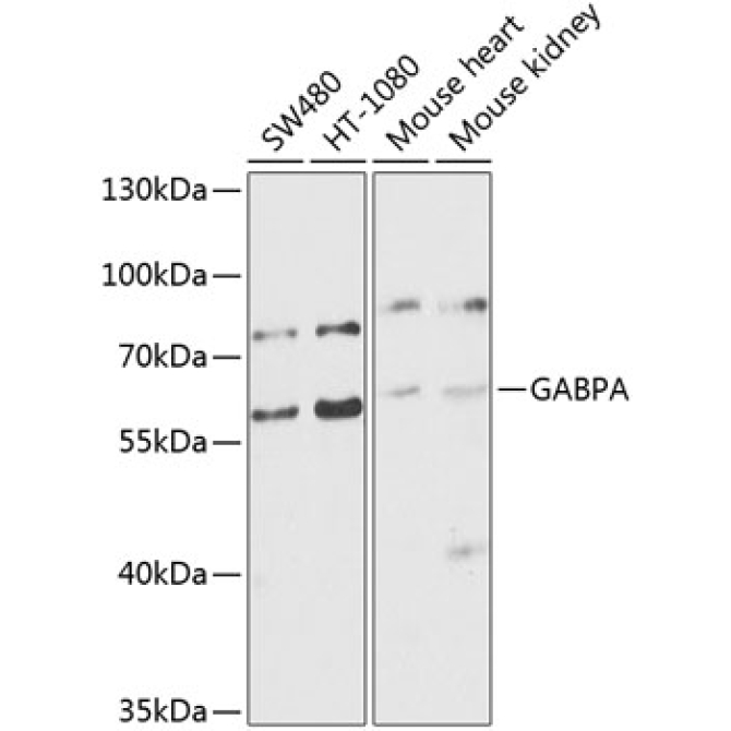 GABPA Rabbit Polyclonal Antibody