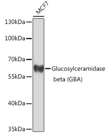 Glucosylceramidase beta (GBA) Rabbit Polyclonal Antibody