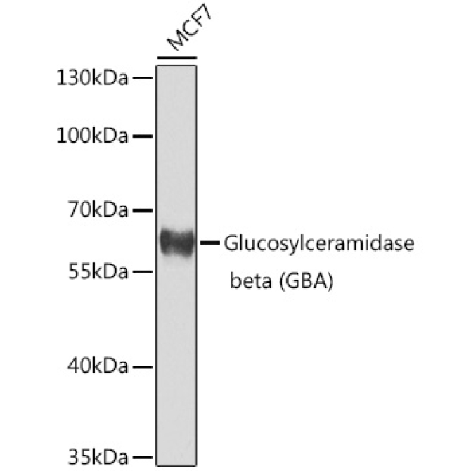 Glucosylceramidase beta (GBA) Rabbit Polyclonal Antibody
