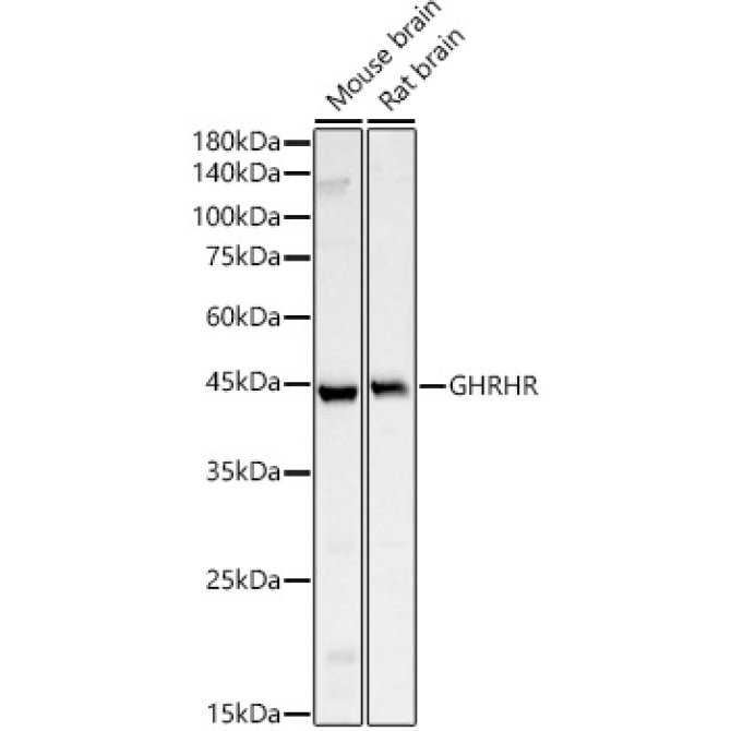 GHRHR Rabbit Polyclonal Antibody