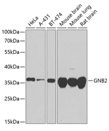 GNB2 Rabbit Polyclonal Antibody