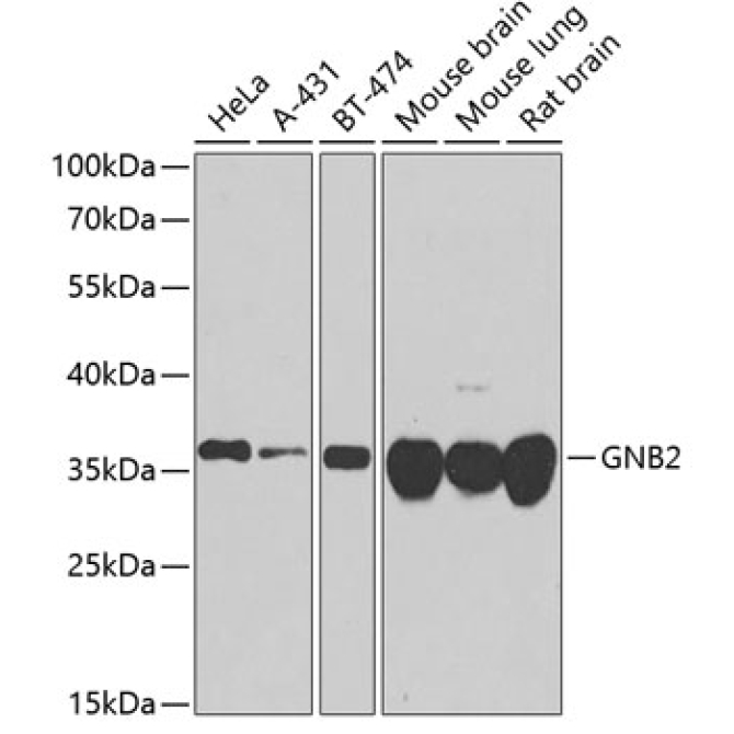 GNB2 Rabbit Polyclonal Antibody