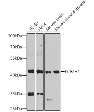 GTF2H4 Rabbit Polyclonal Antibody