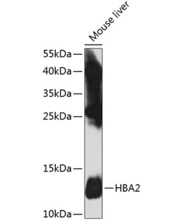 HBA2 Rabbit Polyclonal Antibody